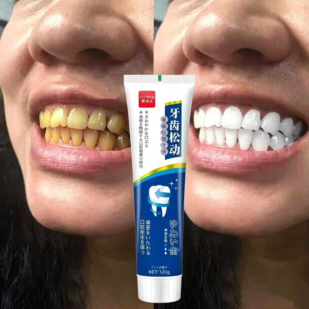 Teeth Whitening Japan - ยาสีฟันญี่ปุ่นนำเข้าสำหรับฟันหลวม ช่วยดูแลสุขภาพช่องปากตลอดทั้งปี สำหรับผู้ใหญ่ ทั้งชายและหญิง ช่วยให้ฟันขาวขึ้น ดูแลช่องปากให้กระจ่างใส