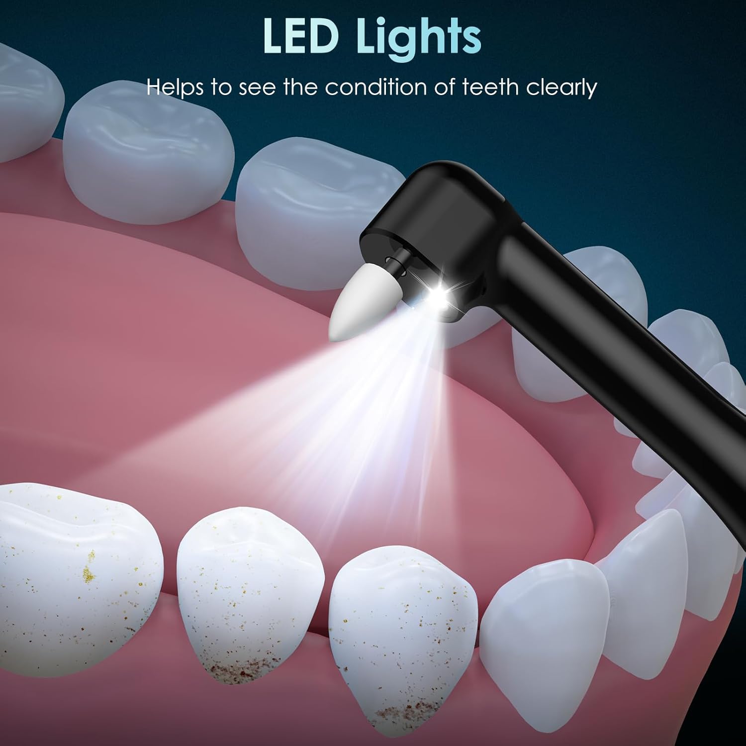 เครื่องขัดฟัน เครื่องขัดฟันแบบ - Teeth Whitening Or Tooth Whitening บทวิจารณ์และราคา