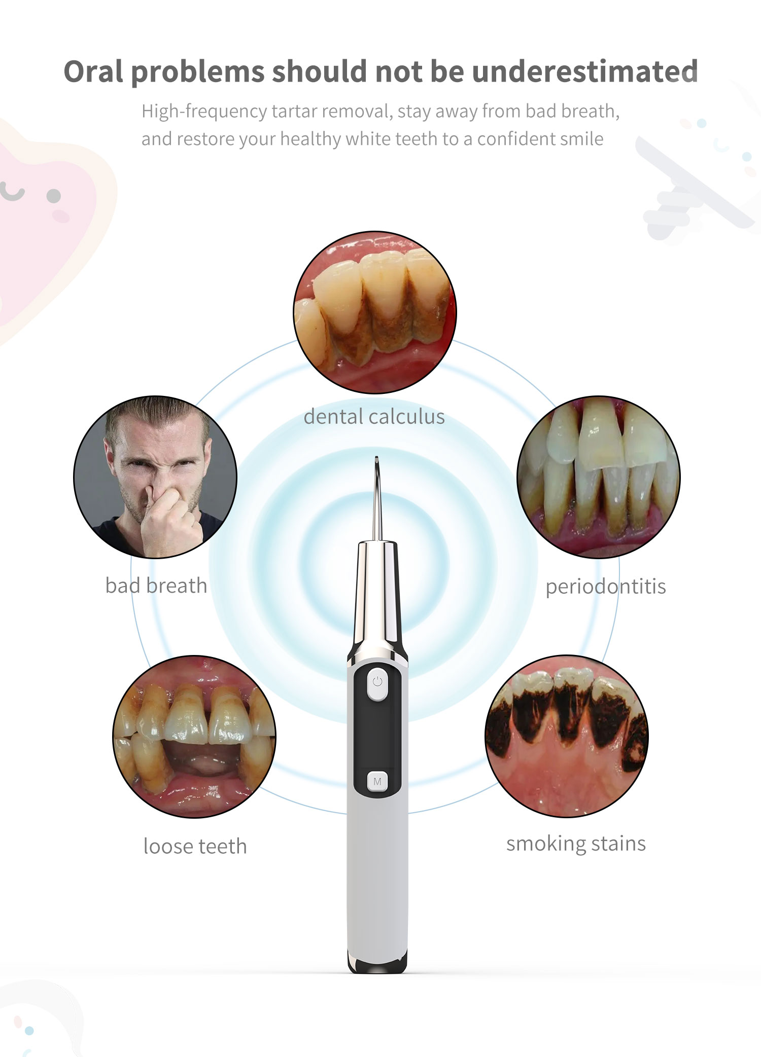 ไฟฟ้าโซนิคทันตกรรมแคลคูลัส Sca - Teeth Whitening Or Tooth Whitening บทวิจารณ์และราคา