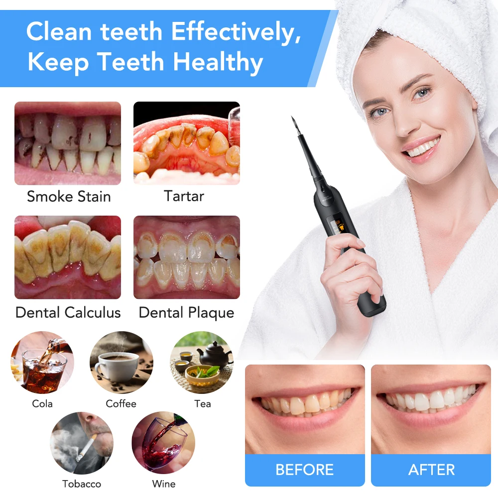 ทันตกรรมไฟฟ้า Scaler ชุดแปรงสี - Teeth Whitening Or Tooth Whitening บทวิจารณ์และราคา