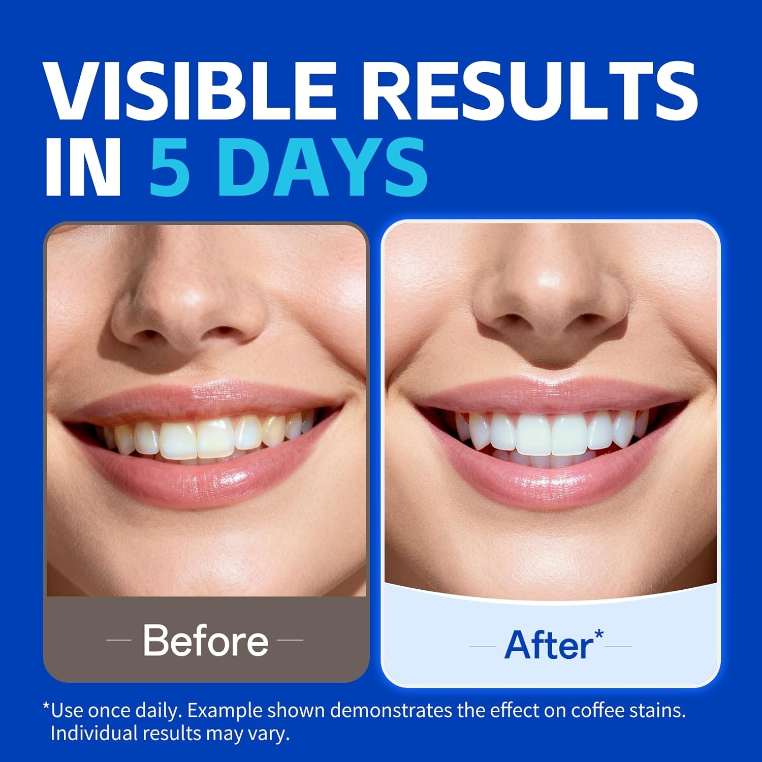แผ่นฟอกสีฟัน KHAZIX 7 คู่ ใช้ง - Teeth Whitening Oil Pulling บทวิจารณ์และราคา